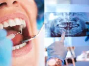 El estado de los dientes puede ser un indicador de muerte prematura, según estudio japonés