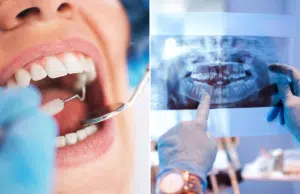 El estado de los dientes puede ser un indicador de muerte prematura, según estudio japonés