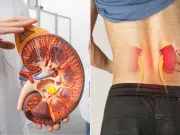 La función renal que puede fallar sin síntomas: esta es la señal silenciosa que alerta a los médicos