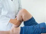 Método Ardila: seis claves para mejorar la calidad de vida de pacientes con linfedema