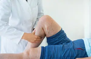 Método Ardila: seis claves para mejorar la calidad de vida de pacientes con linfedema