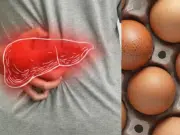 Hígado graso: cuántos huevos se pueden consumir por semana según expertos en nutrición