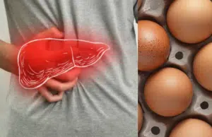 Hígado graso: cuántos huevos se pueden consumir por semana según expertos en nutrición
