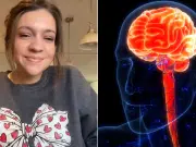 Estirarse el cuello para aliviar tensión casi le cuesta la vida: mujer en Estados Unidos sufre un ACV por un crujido rutinario