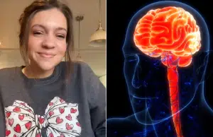 Estirarse el cuello para aliviar tensión casi le cuesta la vida: mujer en Estados Unidos sufre un ACV por un crujido rutinario