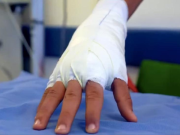1.419 personas lesionadas por pólvora: INS