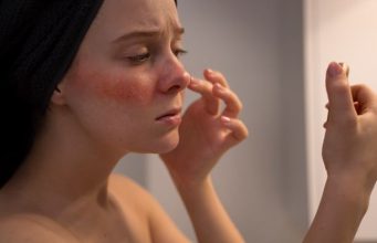 Claves para recuperar la piel después de las vacaciones