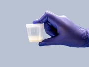 Detectan 42 compuestos químicos de uso cotidiano en el semen que podrían afectar la fertilidad