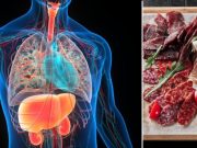 Riesgos de comer salchicha, jamón y otros embutidos si tiene hígado graso: lo que debe saber para cuidar su salud
