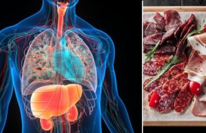 Riesgos de comer salchicha, jamón y otros embutidos si tiene hígado graso: lo que debe saber para cuidar su salud