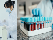 Muestras de sangre seca permiten diagnosticar infecciones hasta siete años después de su obtención: estudio confirma su utilidad epidemiológica