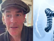 Estos son los síntomas de cáncer de colon, la enfermedad por la que murió James Van Der Beek, actor de ‘Dawson’s Creek’, a los 48 años