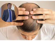 ‘La alopecia androgenética no tiene cura y no existen terapias mágicas con resultados inmediatos’: advierte experto