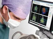 La innovadora técnica para tratar el cáncer de próstata que, gracias al Instituto Nacional de Cancerología, ahora se está aplicando en el país