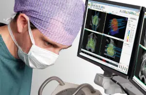 La innovadora técnica para tratar el cáncer de próstata que, gracias al Instituto Nacional de Cancerología, ahora se está aplicando en el país