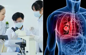 Nuevo sensor óptico permite la detección temprana del cáncer de pulmón con un simple análisis de sangre: anticipa el tumor antes de ser visible
