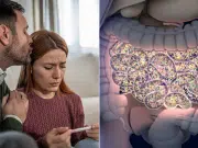 Infertilidad femenina: cómo la microbiota impacta en el equilibrio hormonal y el embarazo