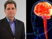 Accidente cerebrovascular (ACV): factores de riesgo, síntomas clave y cómo prevenirlo, según un cardiólogo