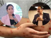 El tuit que enfrenta al subsecretario de Salud de Bogotá y la directora del INS por supuestas demoras en caso de sarampión: ‘me pidieron rectificar’