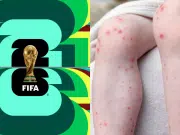 El Ministerio de Salud alerta por posible riesgo de contagio de sarampión durante el Mundial de la Fifa 2026: emitió algunas recomendaciones