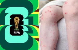 El Ministerio de Salud alerta por posible riesgo de contagio de sarampión durante el Mundial de la Fifa 2026: emitió algunas recomendaciones
