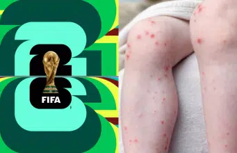 El Ministerio de Salud alerta por posible riesgo de contagio de sarampión durante el Mundial de la Fifa 2026: emitió algunas recomendaciones
