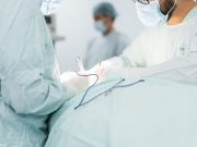 Cáncer de pulmón: principal causa de mortalidad por esta enfermedad en el mundo