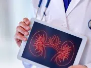 Enfermedad renal silenciosa: expertos alertan sobre la urgencia de detectarla a tiempo; puede reducir hasta 16 años la esperanza de vida