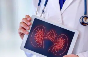 Enfermedad renal silenciosa: expertos alertan sobre la urgencia de detectarla a tiempo; puede reducir hasta 16 años la esperanza de vida