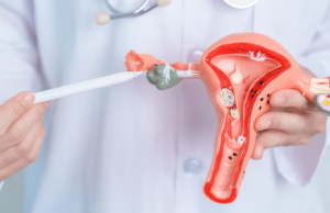 Cáncer de cuello uterino sigue siendo el segundo más frecuente en mujeres en Colombia: puede prevenirse y tratarse con éxito si se actúa a tiempo