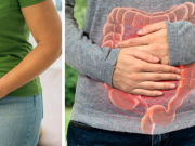 Cuatro síntomas que los cirujanos advierten no ignorar para detectar a tiempo el cáncer de intestino y no confundir con estreñimiento