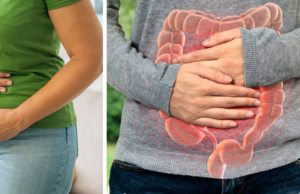 Cuatro síntomas que los cirujanos advierten no ignorar para detectar a tiempo el cáncer de intestino y no confundir con estreñimiento
