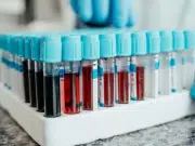 La ciencia descubre el factor RH que la conquista trajo a América: no existía ese tipo de sangre en el continente