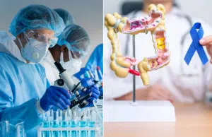 Avances en la prevención del cáncer de colon como estrategia en la salud: el modelo que se aplica en Argentina y que funciona como guía en Colombia