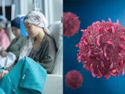 Fundaciones radican solicitud de medidas cautelares ante la CIDH por pacientes con cáncer y enfermedades hepáticas y renales en Colombia