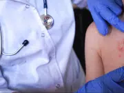 Bogotá ofrece su laboratorio para agilizar la confirmación de casos de sarampión