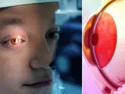 ¿Ve moscas volantes? Esto podría ser un problema serio en su retina y los oftalmólogos explican cuándo acudir por los ‘bichitos’ del ojo
