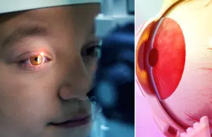¿Ve moscas volantes? Esto podría ser un problema serio en su retina y los oftalmólogos explican cuándo acudir por los ‘bichitos’ del ojo