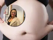 ¿Tengo sobrepeso o tengo obesidad? Experta médica explica la diferencia entre ambas patologías