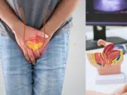 El tratamiento contra la incontinencia urinaria que por tabú muchos pacientes no hacen y les mejoraría la vida