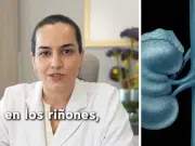 ¿Se debe eliminar la leche y el queso para evitar cálculos en los riñones? ‘Esto es falso’, dice Eva Martínez, uróloga