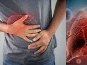 Estos son los síntomas tempranos de la cirrosis hepática, según la Clínica Mayo