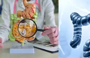 Cáncer de colon aumenta en adultos jóvenes menores de 50: los médicos ya saben por qué está pasando esto