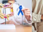Seis señales del cáncer de intestino en su etapa inicial que no debe ignorar