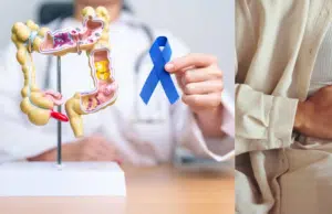 Seis señales del cáncer de intestino en su etapa inicial que no debe ignorar