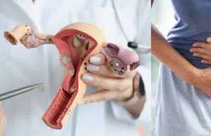 Tres señales del cáncer de cuello uterino que se pasan por alto