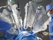 Cirugía robótica en Colombia: así funciona y por qué cada vez se usa más
