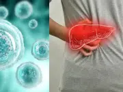Investigadores de la Clínica Mayo identifican ‘células zombi’ responsables de inflamación en hígado graso
