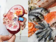 Insuficiencia renal: qué pescado es recomendable consumir y cuáles evitar en la dieta