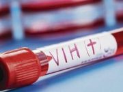 Un trasplante de células madre logra la curación del VIH en el décimo paciente